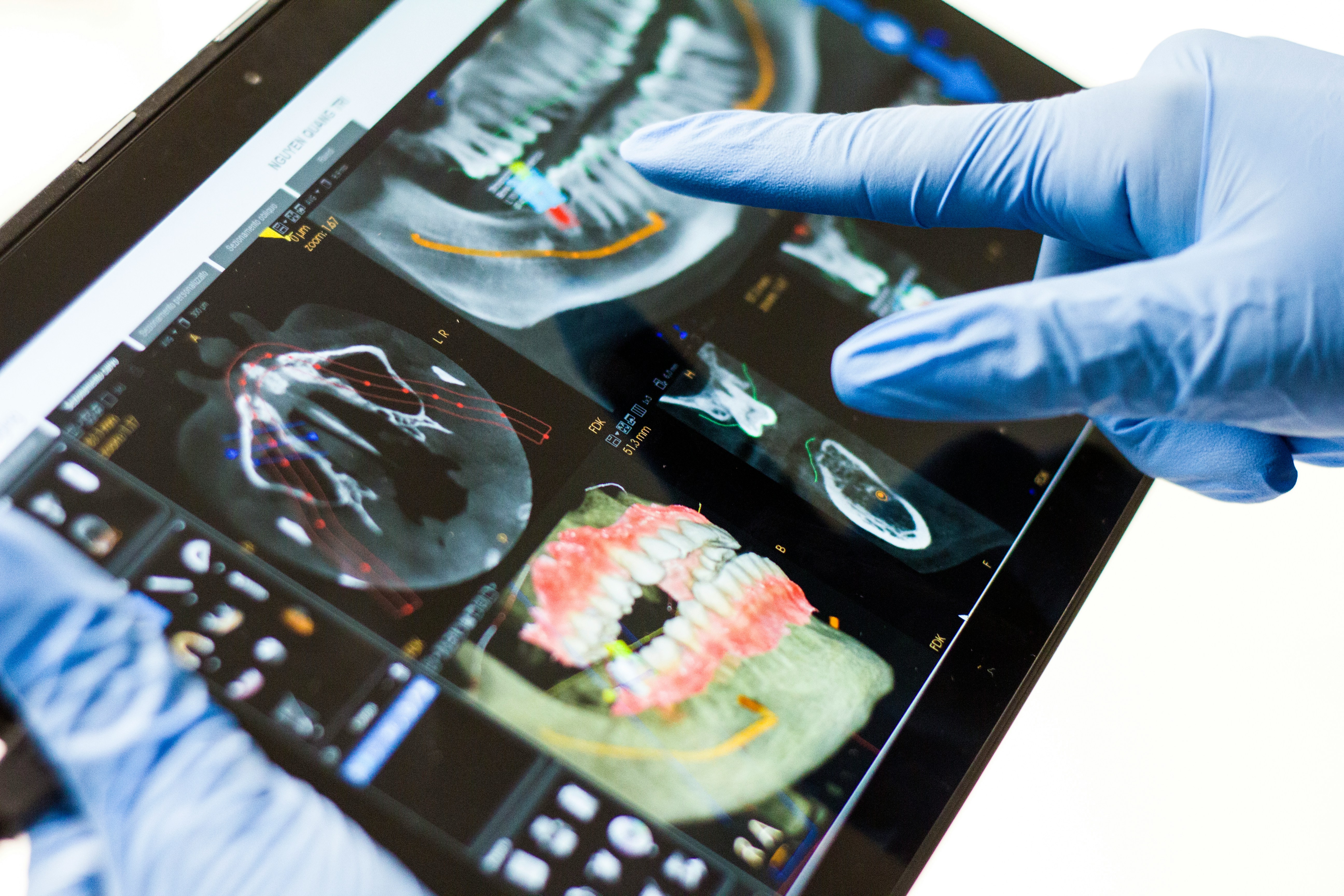 Tecnología digital escáner 3D dental