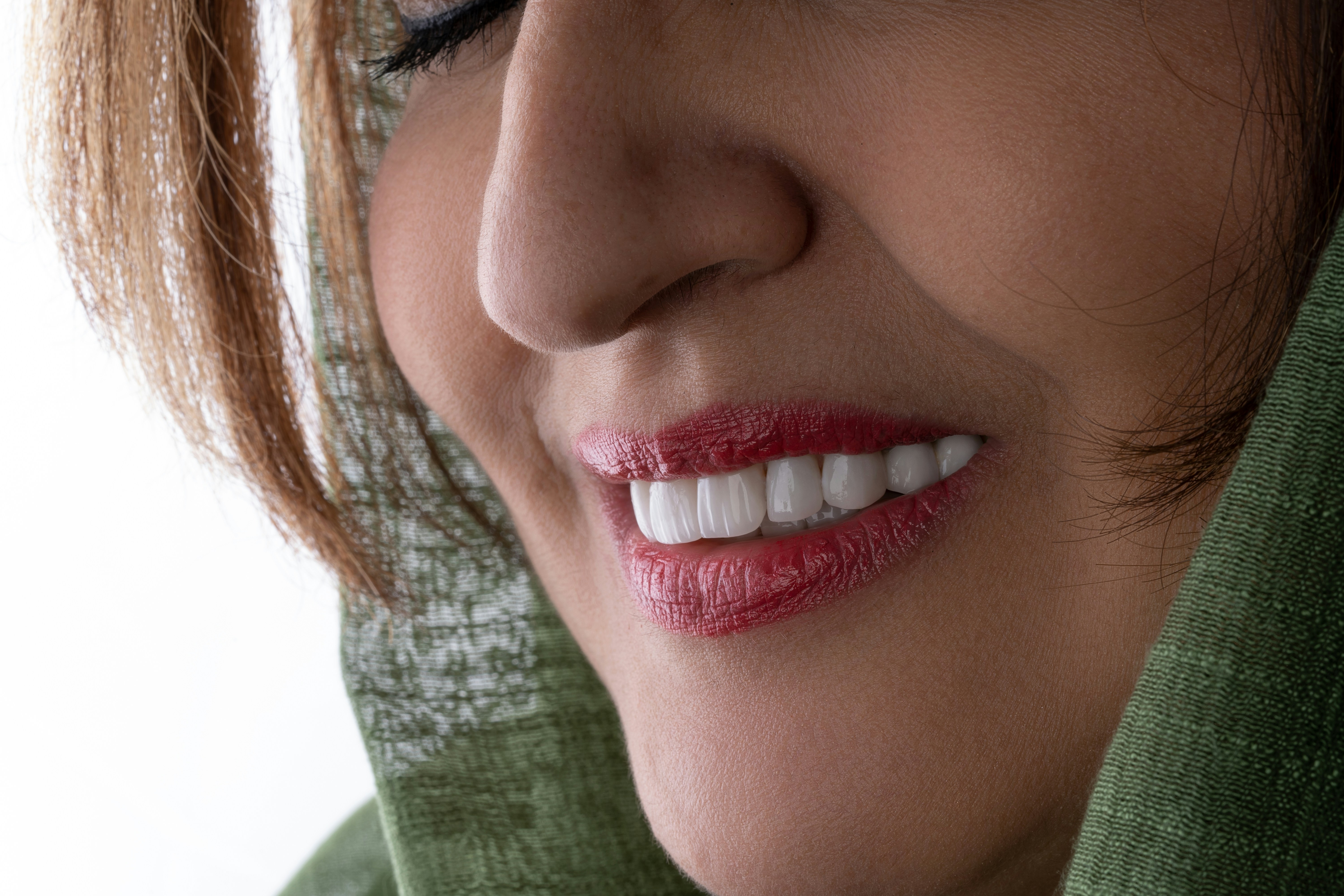 Diseño de sonrisa blanqueamiento carillas porcelana estética dental