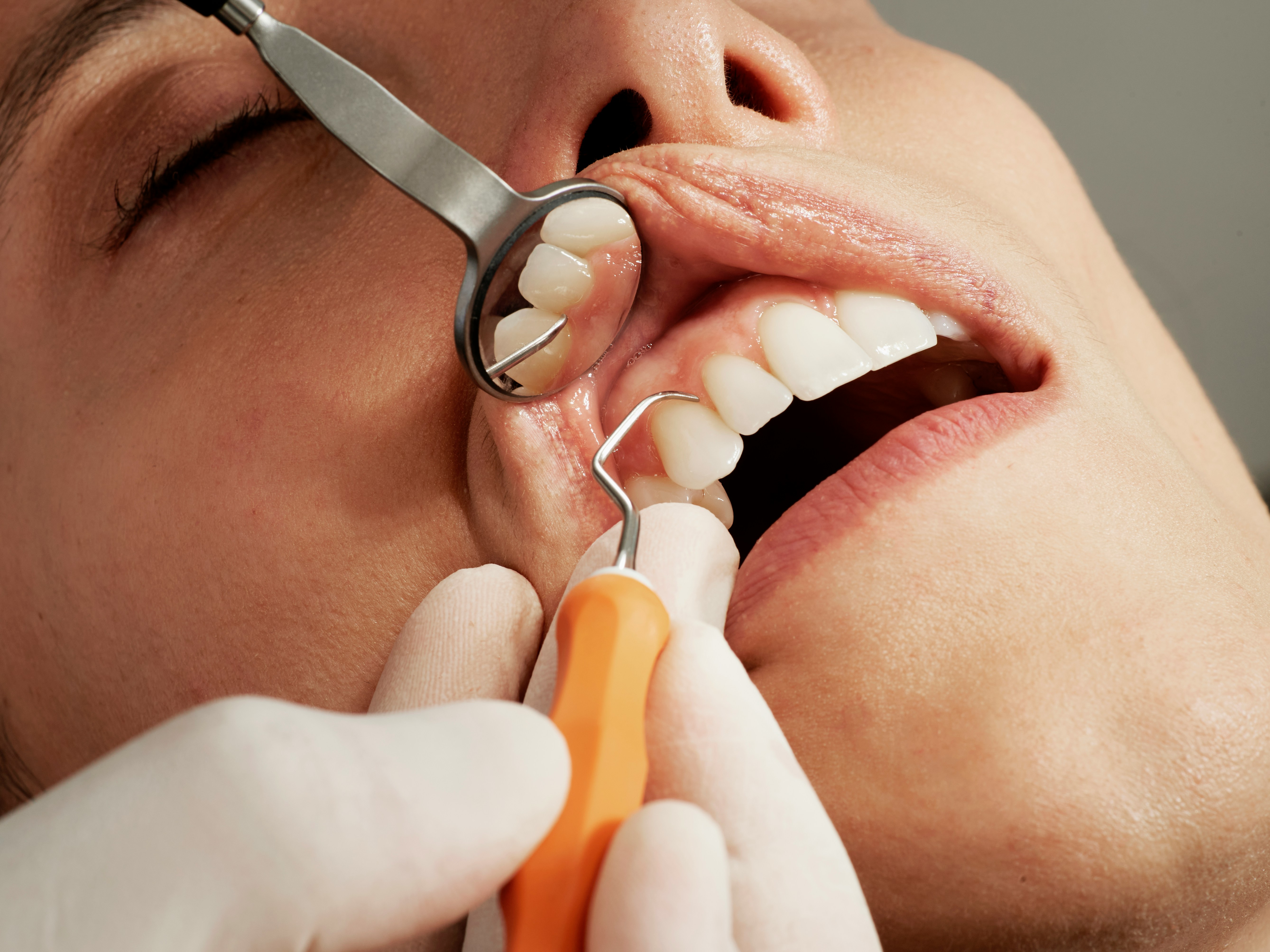 Periodoncia tratamiento encías enfermedad periodontal clínica dental